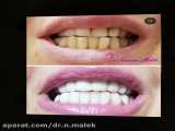اصلاح اصولی فرم دندانها