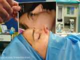 جراحی بینی پهن توسط دکتر امید ابراهیمی بهترین جراح بینی