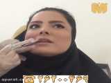 تزریق ژل لب در فیلم