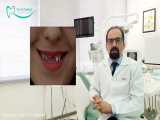 ایمپلنت و کاشت دندان در اصفهان توسط دکتر محمد عاطفت متخصص زیبایی