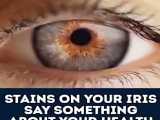 با تغییر رنگ چشم، از بیماری جلوگیری کنید.