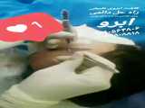 تغییر شکل ابرو در کلینیک شیرزادگان