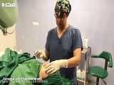 فیلم جراحی بینی حین عمل
