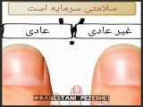 بهداشت سرمایه مهم است