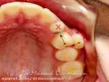 ارتودنسی نامرتبی دندانی | دکتر مسعود داودیان