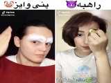 کدوم چشم؟؟؟