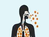 همه آنچه باید درباره آنفولانزا و راه‌های مقابله با آن بدانیم