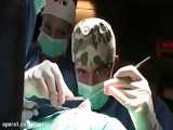 جراحی باز بینی  چگونه صورت می گیرد ؟ | دکتر اهوازی | جراح پلاستیک  در تهران