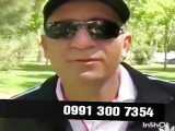 روش‌های درمان میگرن
