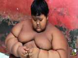چاق ترین پسر دنیا بالاخره لاغر شد