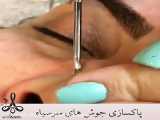 تمیز کردن چهره