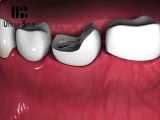 پست و کر دندان  |  دکتر لیلا عطایی 