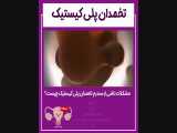 مشکلات کوتاهی تخمدان