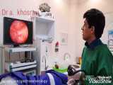 تشخیص آپاندیس برگشت خورده  در بیمار با کولونوسکوپی توسط دکتر اصغر خسروی