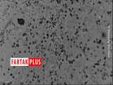 اولین فیلم از ویروس کرونا در زیر میکروسکوپ 