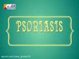 بیماری پوستی پسوریازیس را بهتر بشناسیم و درمان پسوریازیس را جدی بگیریم..