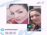 جراحی بینی با شماره تماس 09380000893