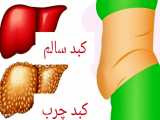 طرز سالمی برای حفظ سلامت کبد