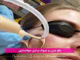 تلاش برای جوانسازی