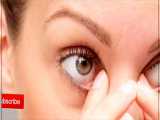 علت پف دور چشم در صبحگاه چیست و چگونه میتوان آن رو درمان کرد؟