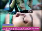 فیلم جراحی بینی توسط دکتر حاتم صالح پور