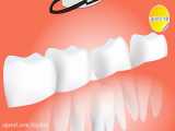 ۵ مشکلی که با دندان درد اشتباه گرفته می شود