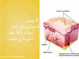 چرا با گلنودرما پیسی درمان میشود؟