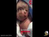 تولد نوزادی عجیب الخلقه در تهران