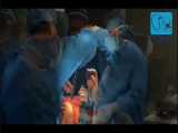 فیلم جراحی مفصل زانو 