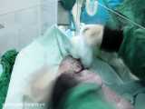 لحظه ی به دنیا آمدن نوزاد در بیمارستان