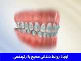 ایجاد روابط دندانی صحیح با ارتودنسی | دکتر احسان مهریزی 