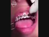 ارتودنسی دندان | دندانستان 