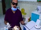 جراحی بافتهای دهان و دهان با لیزر سیرونا