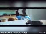 درمان مشکلات رویش مو