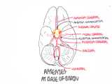 Brain-circle of Willis and stroke 
