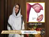 تنبلی تخمدان یا پلی کیستیک | دکتر سوزان پیروان | متخصص زنان تهران 