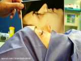 جراحی بینی استخوانی توسط دکتر امید ابراهیمی بهترین جراح  بینی
