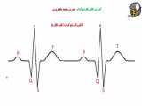 آموزش الکتروکاردیوگرام