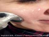 لیفت پوست با کلد پلاسما در مطب خانم دکتر متینه پاکیده 02177877813