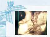 فیلم چهار بعدی جنین پسر بچه ی توپولوی ما در سی و هشت هفتگی