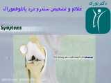 علائم سندرم درد پاتلوفمورال