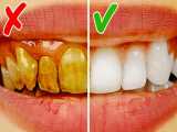 روشی ساده برای سفید شدن دندان
