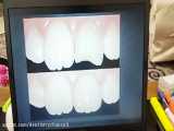 لایو اموزشی اناتومی دندانهای قدامی بخش دوم (دکتر اکبری)