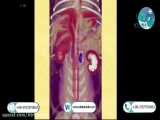 _Adrenal ultrasound - unilateral or bilateral in atrina