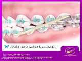 الو دکتر- روش های مختلف ارتودنسی (مرتب کردن دندان ها)