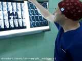 نورومانیتورینگ عمل جراحی میلوپاتی گردنی Laminectomy Cervical