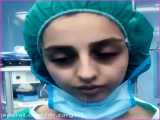 نمونه کار جراحی بینی دکتر کاظم زرگری