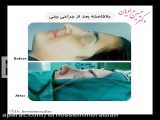 نمونه کار های جراحی زیبایی بینی | جراح بینی شیراز