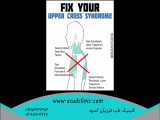 ورزشهایی برای درمان سندروم کراس