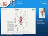 AKi in Covid-19 patients mechanisms and management